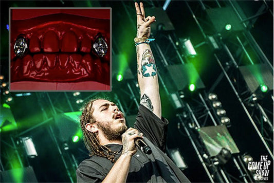 Post Malone performing on stage with a hand gesture, showing off his diamond-encrusted grill, illuminated by green stage lights.